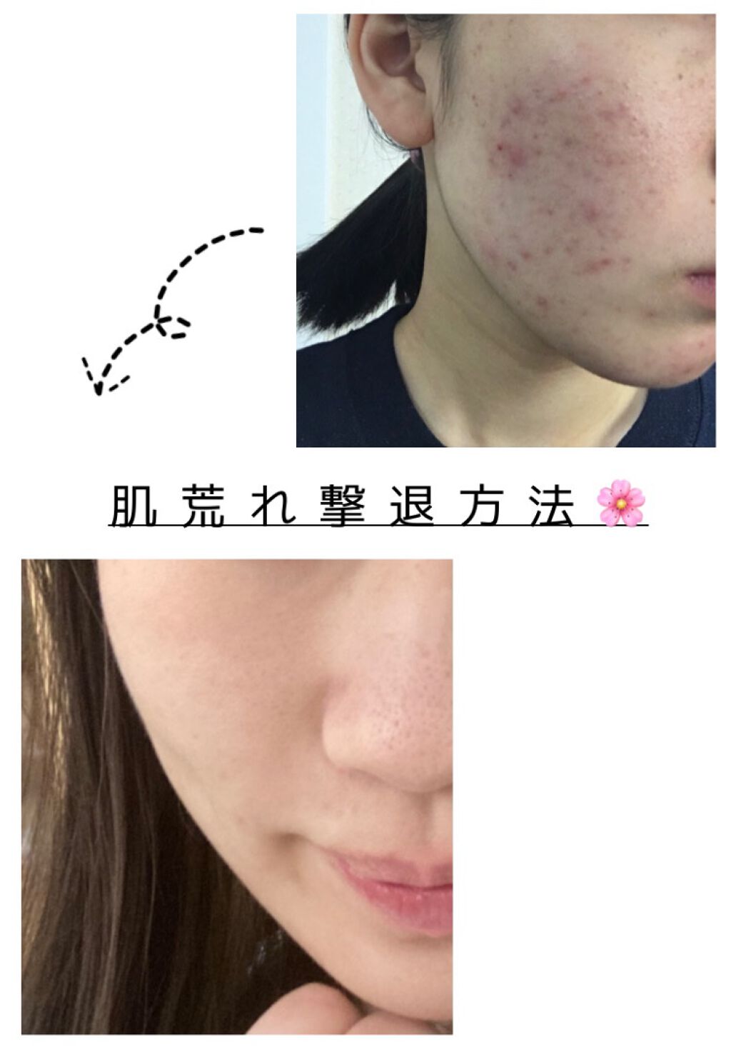 なめらか本舗 乳液 NA/なめらか本舗/乳液を使ったクチコミ(1枚目)