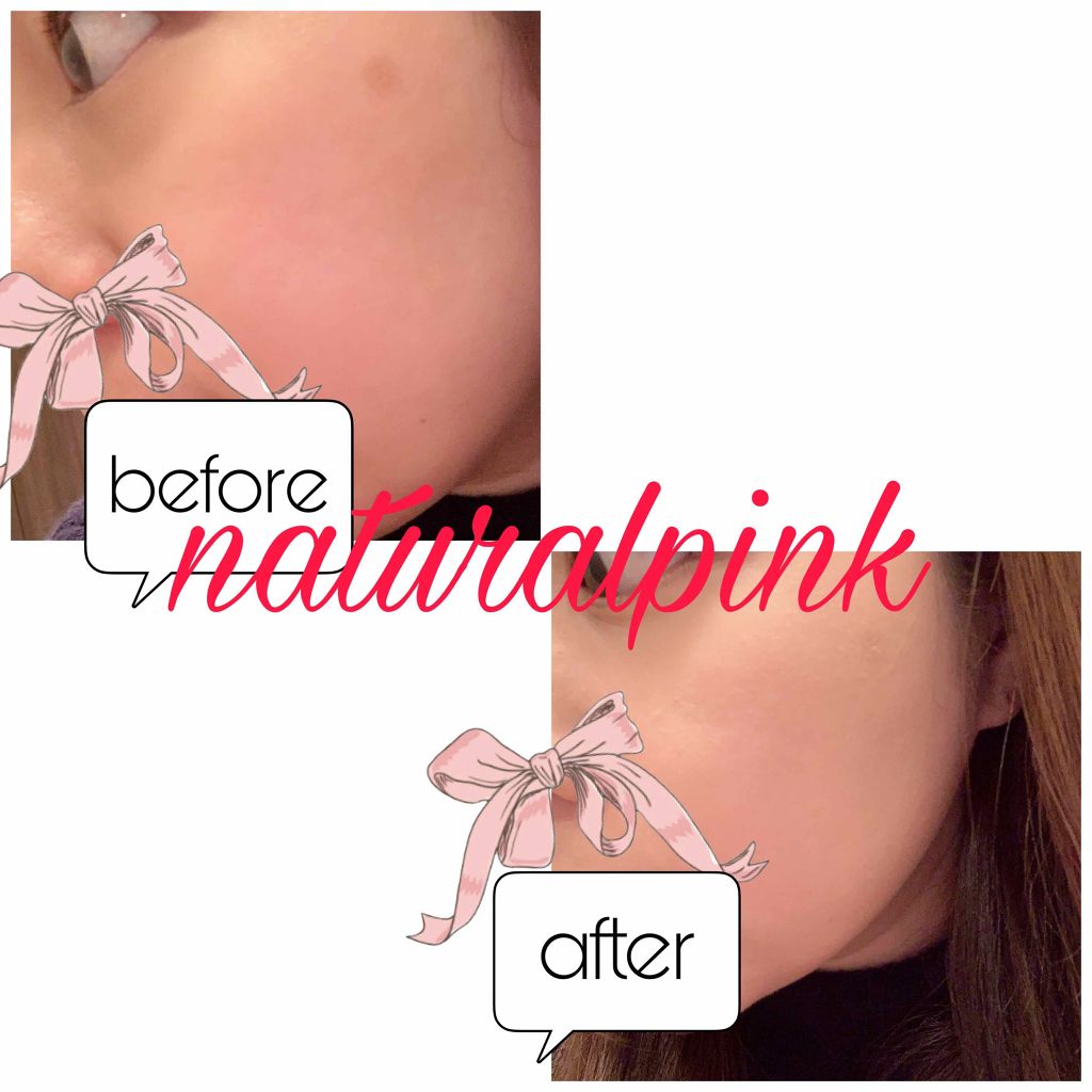 こまっきーファンデーション /Komacky/リキッドファンデーションを使ったクチコミ（2枚目）