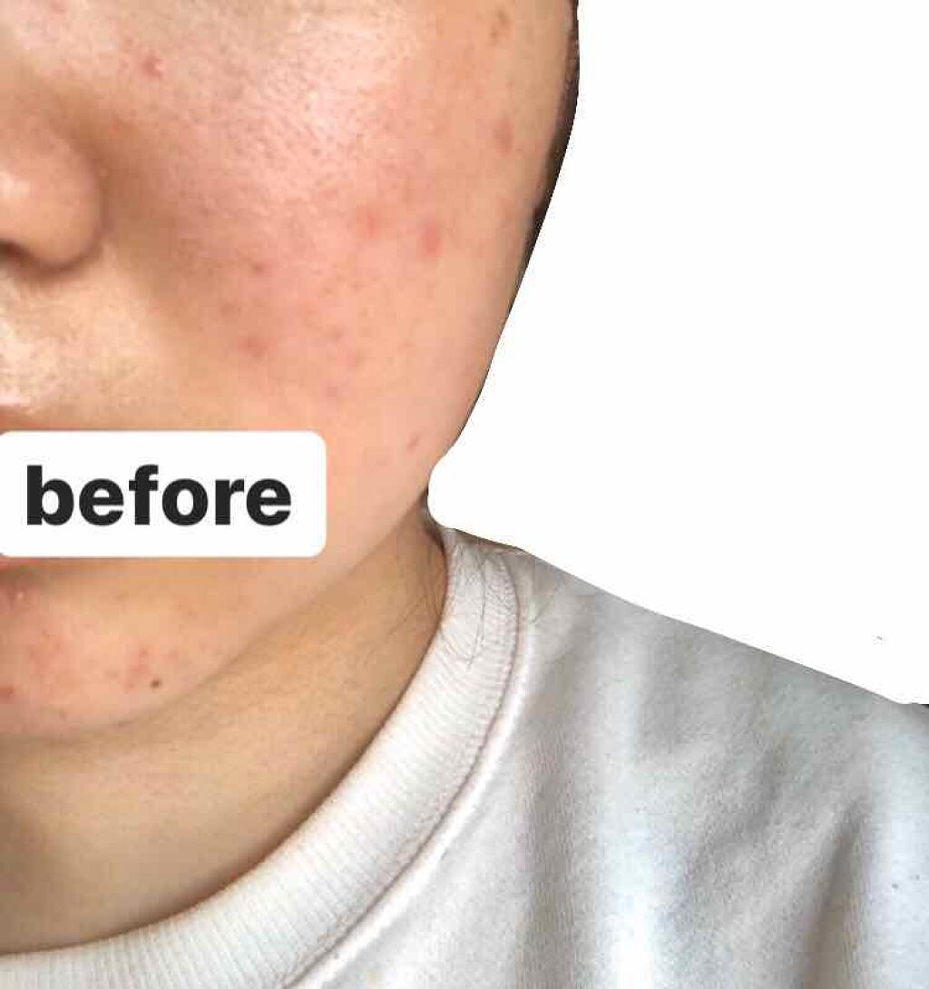 ミノン アミノモイスト モイストチャージ ミルク/ミノン/乳液を使ったクチコミ(2枚目)