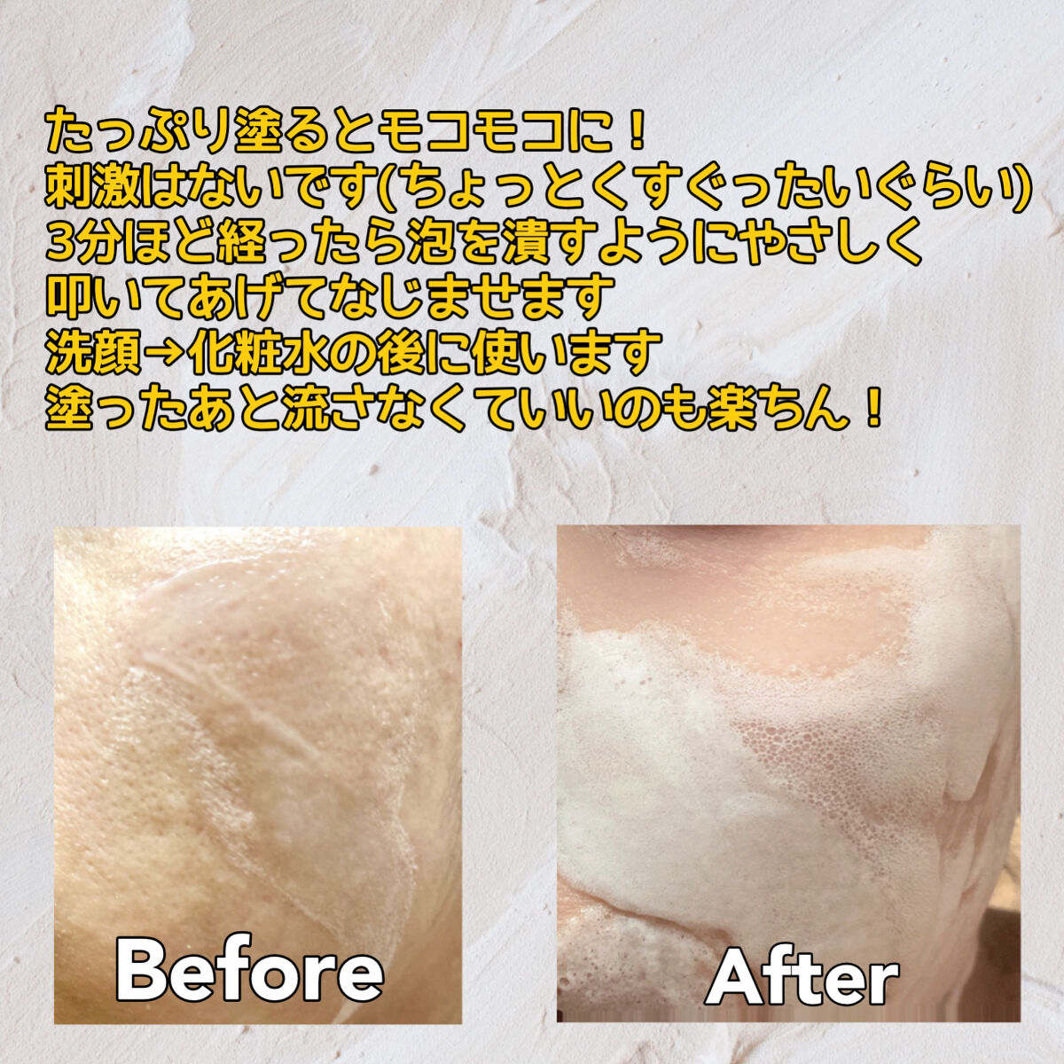 マジックバブルエッセンスパックMINI/BAKER7/シートマスク・パックを使ったクチコミ（3枚目）