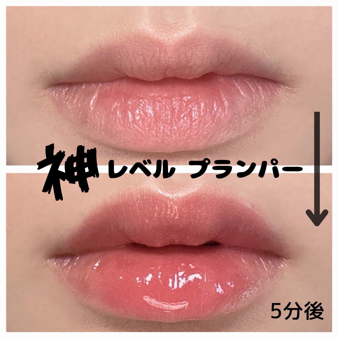 ドトムリッププラスプランパー/keybo/リッププランパーを使ったクチコミ（1枚目）