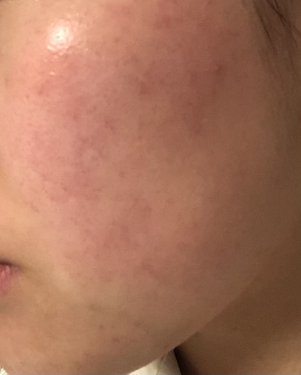 グリーンダーマCICAセラム/ネイチャーリパブリック/美容液を使ったクチコミ（1枚目）