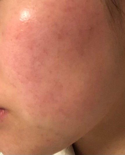 CICA クリーム/VT/フェイスクリームを使ったクチコミ(1枚目)