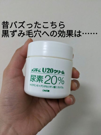 U20クリーム(医薬品)/メンターム/その他を使ったクチコミ(1枚目)