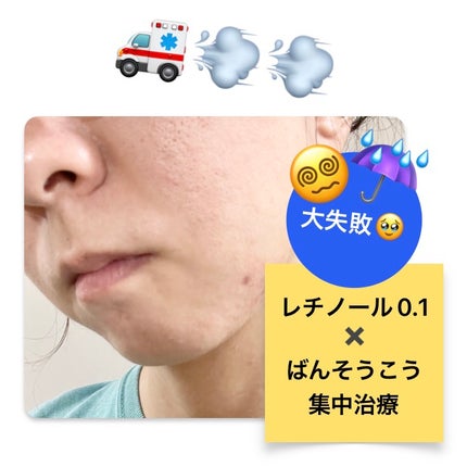 RXザ・ビタミンC23セラム/COSRX/美容液を使ったクチコミ(1枚目)