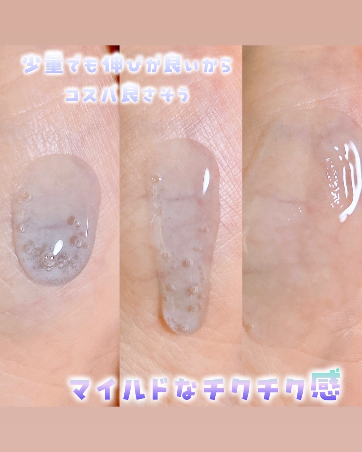 ニードルセラムAZ/fractionalCC/美容液を使ったクチコミ（2枚目）