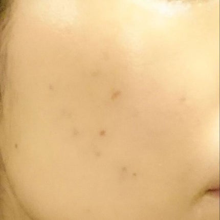 アクアミルク/アクアレーベル/乳液を使ったクチコミ(1枚目)