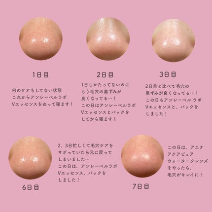 アクアピュア ウォータークレンズ/AENA(アエナ)/美顔器・マッサージを使ったクチコミ(3枚目)