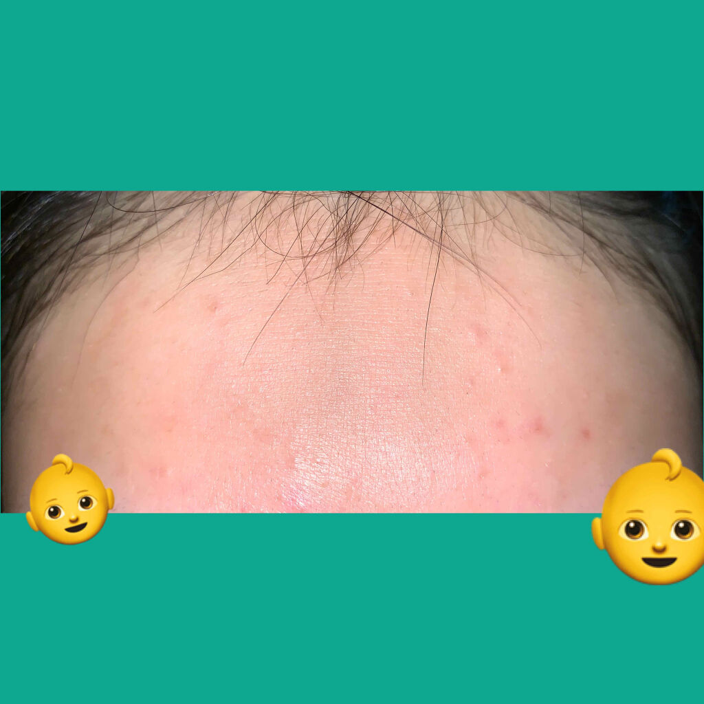 クリアケア化粧水/無印良品/化粧水を使ったクチコミ（2枚目）