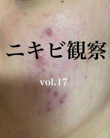 敏感肌用薬用美白美容液/無印良品/美容液を使ったクチコミ（1枚目）