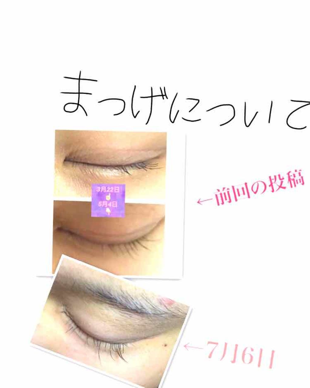 EMAKED(エマーキット)/水橋保寿堂製薬/まつげ美容液を使ったクチコミ(1枚目)