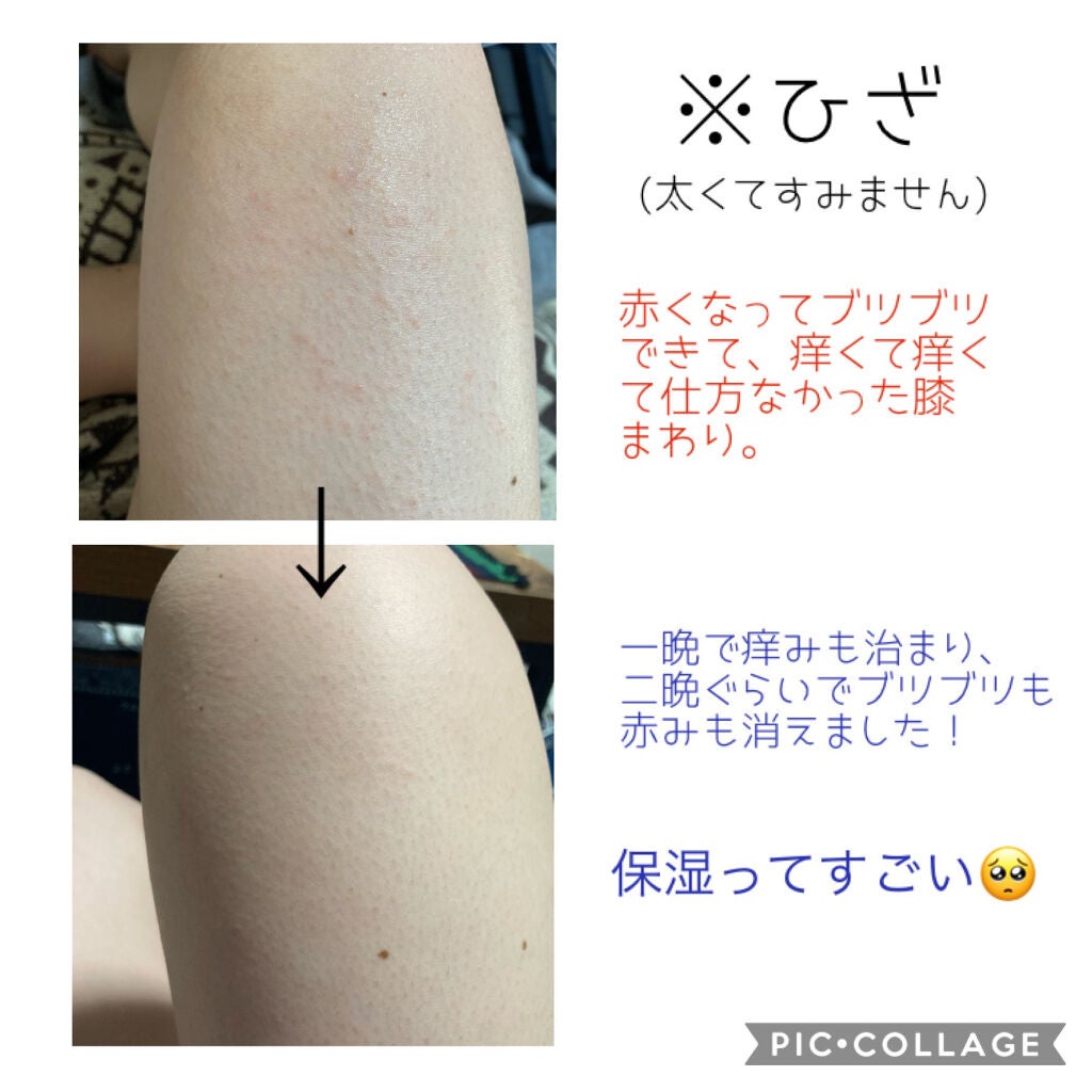 ハトムギ化粧水(ナチュリエ スキンコンディショナー R )/ナチュリエ/化粧水を使ったクチコミ(2枚目)