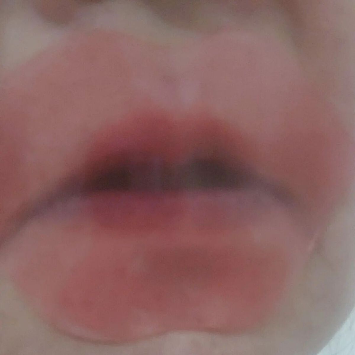 ハイドロゲルリップパック/CHOOSY/シートマスク・パックを使ったクチコミ（3枚目）