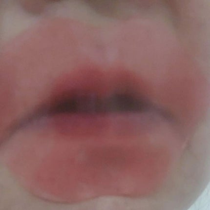 ハイドロゲルリップパック/CHOOSY/シートマスク・パックを使ったクチコミ(3枚目)