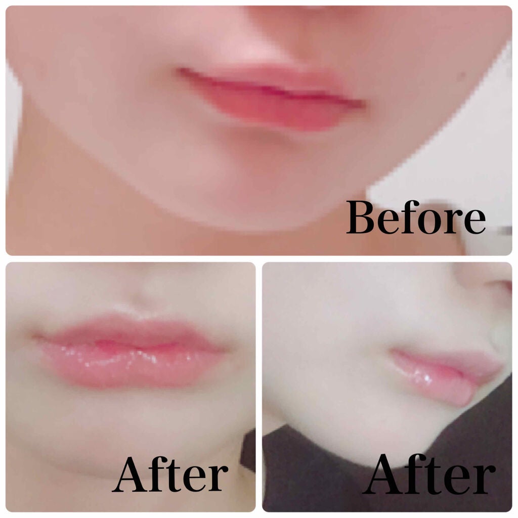 ラシャスリップス/ラシャスリップス/リップグロスを使ったクチコミ(2枚目)