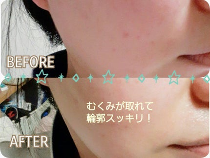 PLUMINUS/mous./美顔器・マッサージを使ったクチコミ(4枚目)