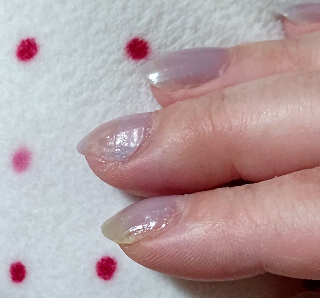 スプリットリペアN/ネイルネイル/ネイルオイル・トリートメントを使ったクチコミ（1枚目）