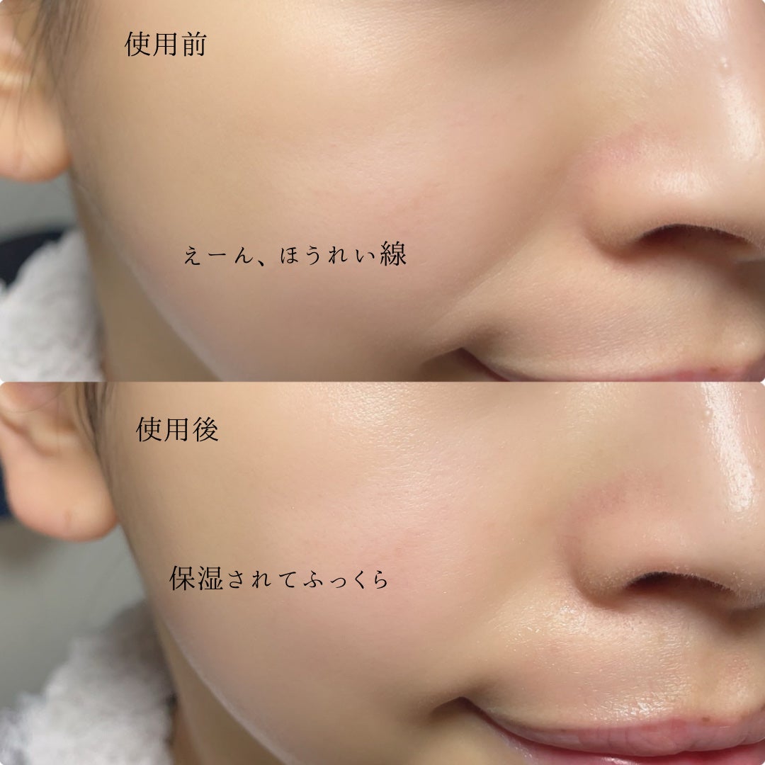 シカピーリングトナーパッド/ONE THING/トナーパッドを使ったクチコミ(8枚目)