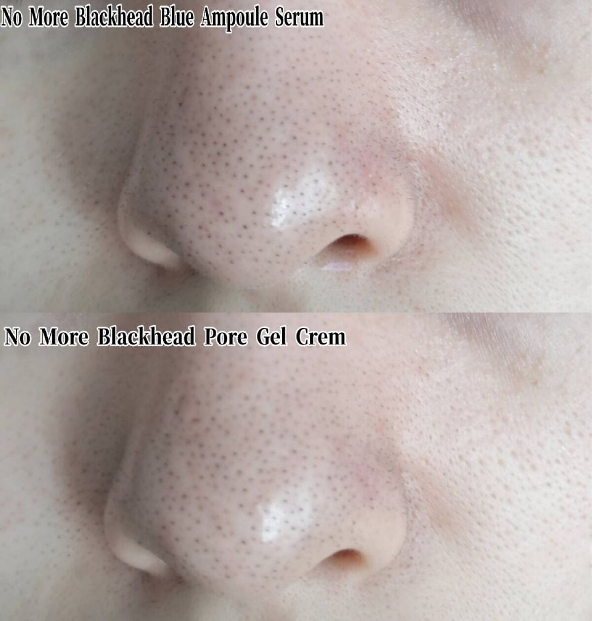 ノーモアブラックヘッド(ノーズピーリング)/One-day's you/スクラブ・ゴマージュを使ったクチコミ(10枚目)