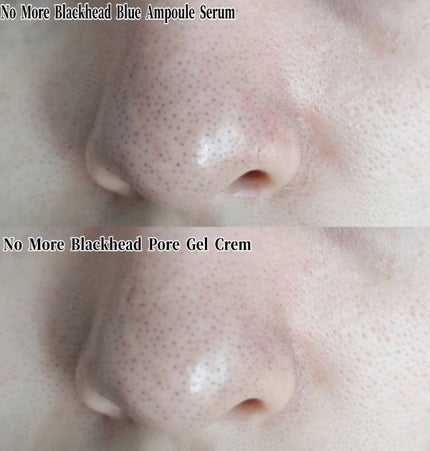 ノーモアブラックヘッド(ノーズピーリング)/One-day's you/スクラブ・ゴマージュを使ったクチコミ(10枚目)