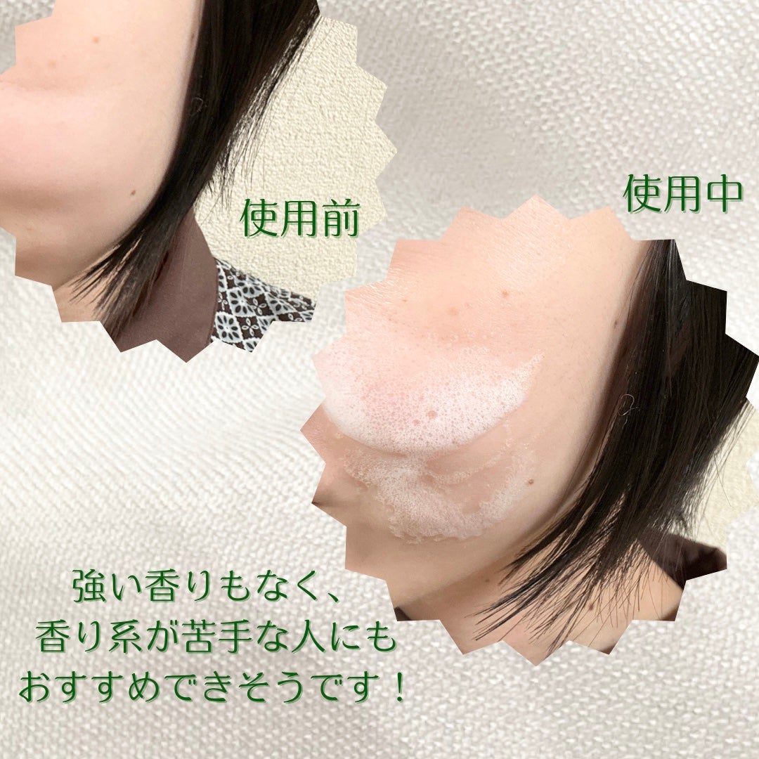 バランシングシカブレミッシュバブルクレンザー/Roume/泡洗顔を使ったクチコミ(4枚目)