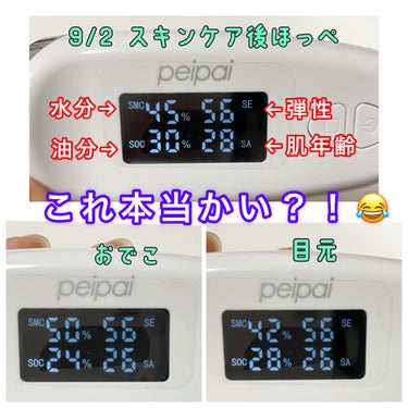 peipai 肌年齢チェッカーのクチコミ「みなさん,こんばんは☆。.:＊・゜

Q10メガ割始まりましたね～😆⭐
年に４回もある散財期間.....」（2枚目）