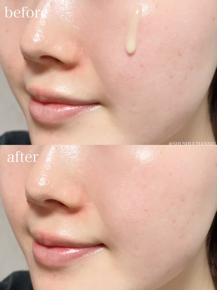 ブラックスネイルレチノールセラム/Dr.G/美容液を使ったクチコミ(6枚目)