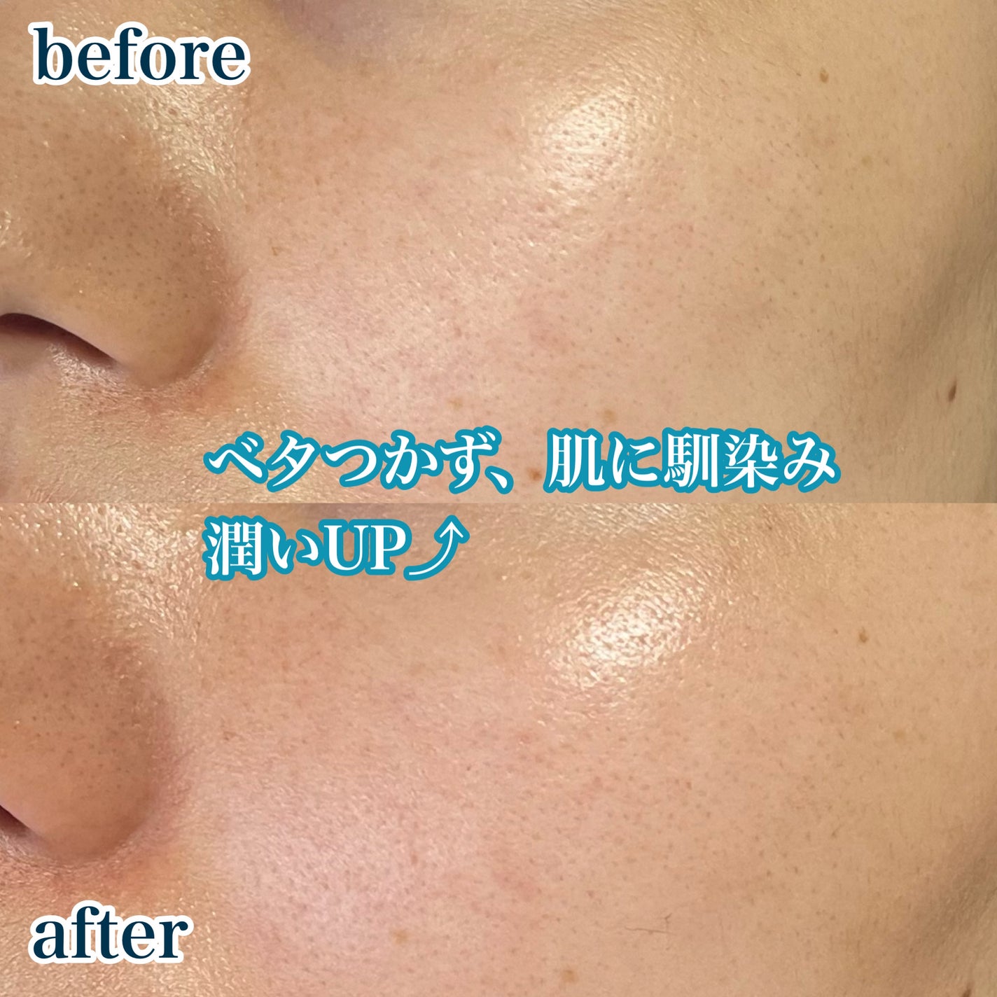 ヒアルーシカ ウォーターフィット サンセラム/SKIN1004/日焼け止めローションを使ったクチコミ(7枚目)