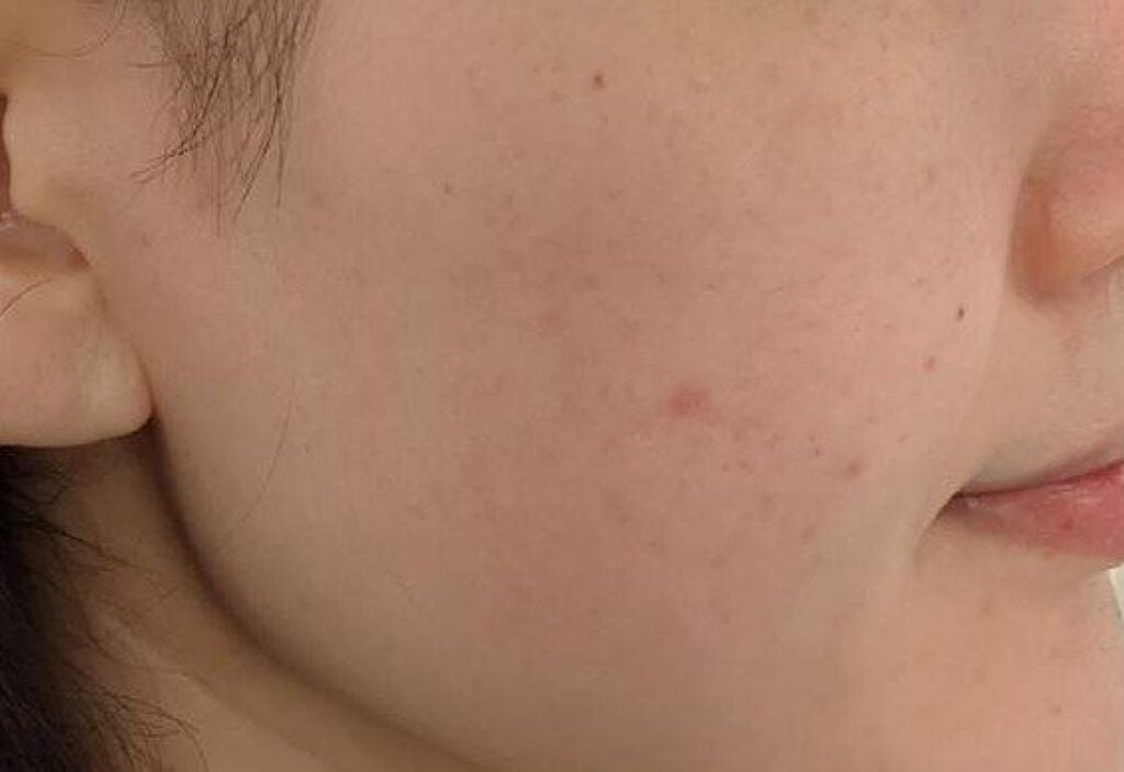 テラスキン/LINE REPAIR/美容液を使ったクチコミ(4枚目)