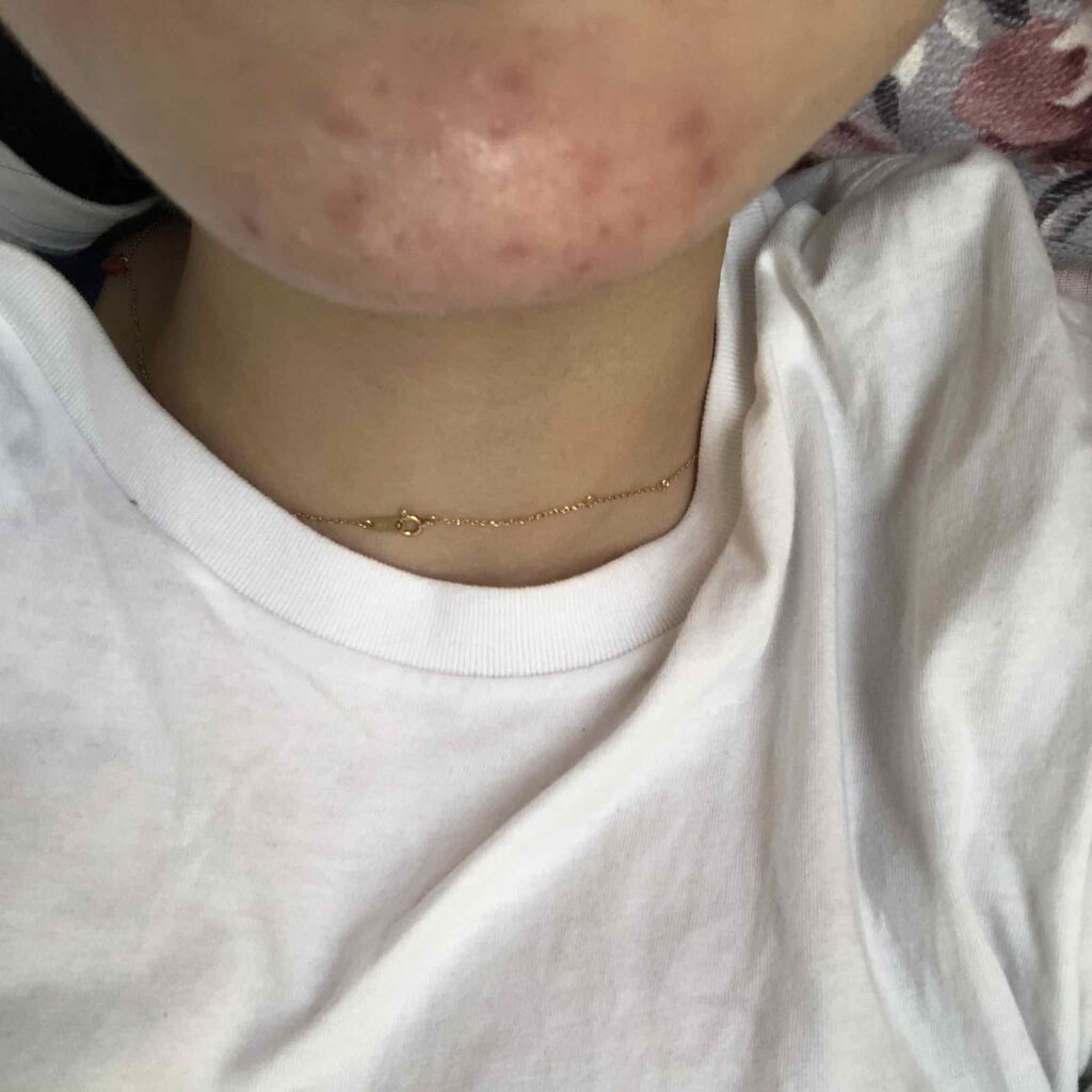 orange_perfume_2opm on LIPS 「おはようございます🎶寝不足続きで肌は悪くなる一方です、、、生理..」(4枚目)