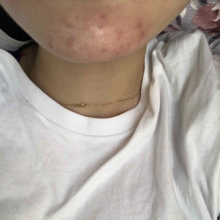 orange_perfume_2opm on LIPS 「おはようございます🎶寝不足続きで肌は悪くなる一方です、、、生理..」(4枚目)