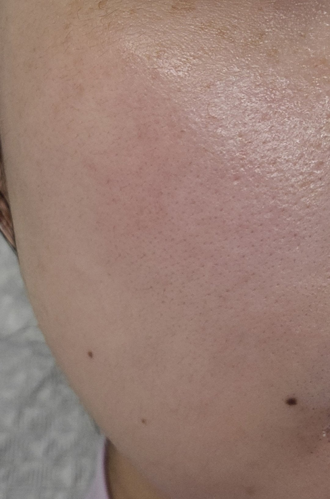 アビブ グルタチオンソームダークスポットセラムビタドロップ/Abib /美容液を使ったクチコミ(10枚目)