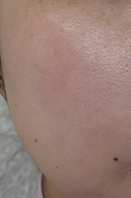 アビブ グルタチオンソームダークスポットセラムビタドロップ/Abib /美容液を使ったクチコミ(10枚目)