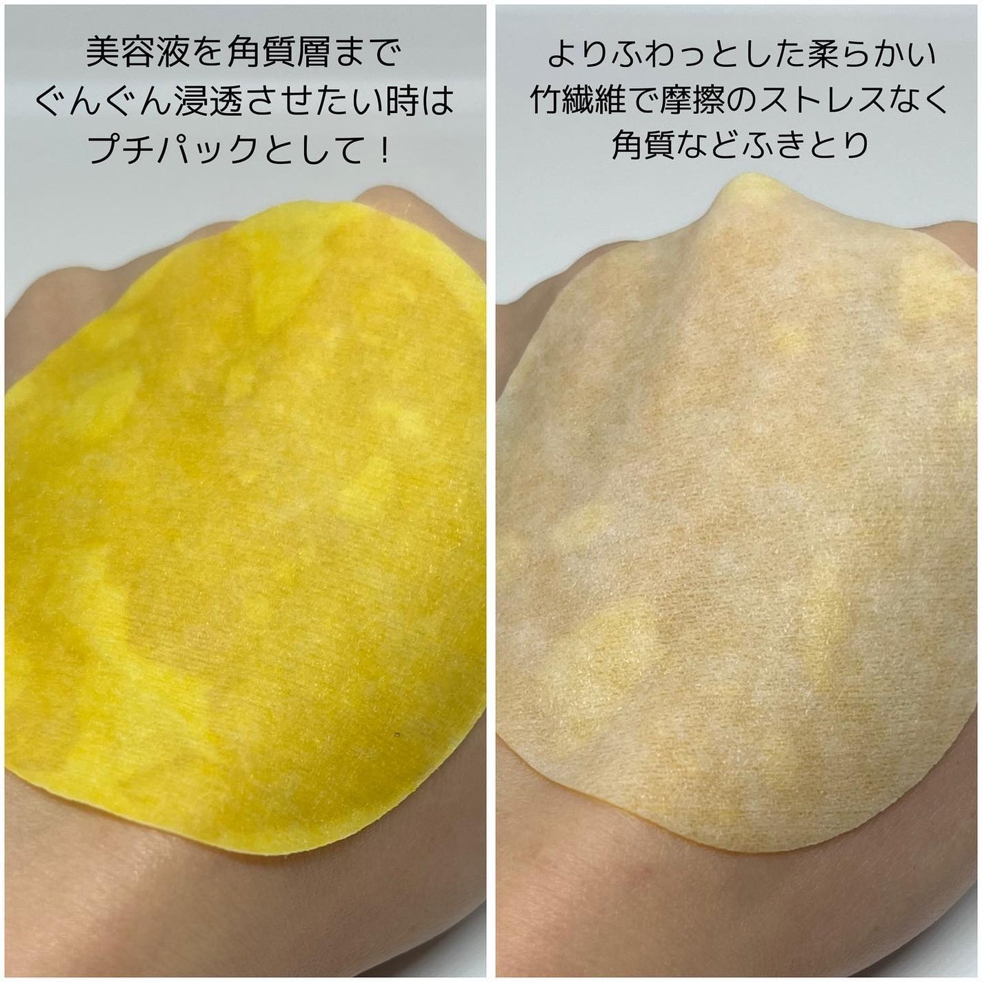 ビタC グリーンティーエンザイム ブライト パッド/innisfree/トナーパッドを使ったクチコミ(3枚目)