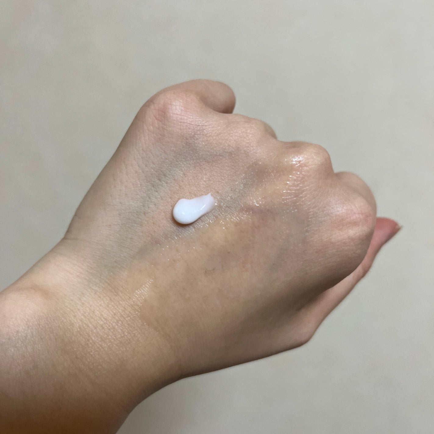 アポスティークリーム(医薬品)/アポスティー/その他を使ったクチコミ(2枚目)