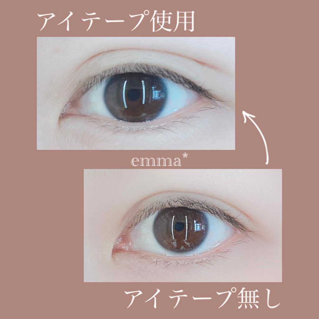 アイテープ(絆創膏タイプ、レギュラー、70枚)/DAISO/二重まぶた用アイテムを使ったクチコミ(2枚目)