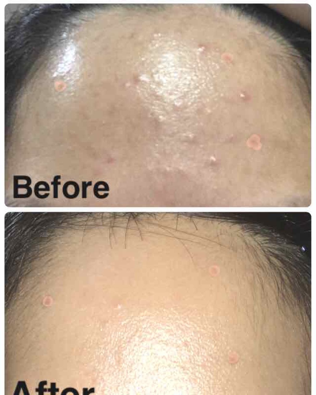 ILiT Cream（アイリット クリーム）/アイリット/フェイスクリームを使ったクチコミ（3枚目）