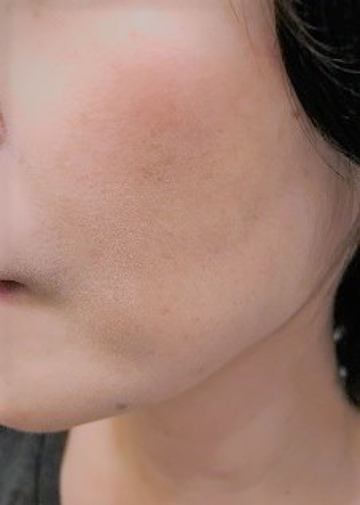 薬用 スキンケア パウダー/アクネオ/プレストパウダーを使ったクチコミ（1枚目）