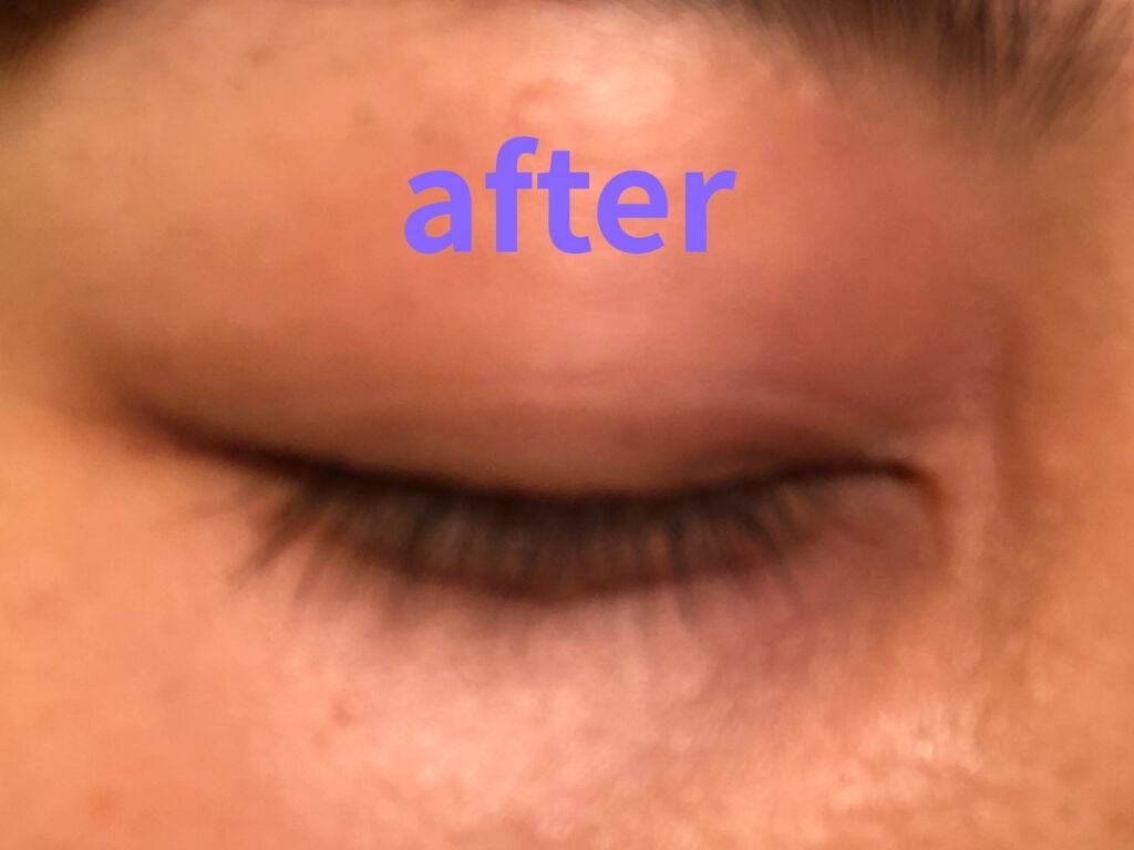 エターナルアイラッシュ/リュバンブラン/まつげ美容液を使ったクチコミ(2枚目)