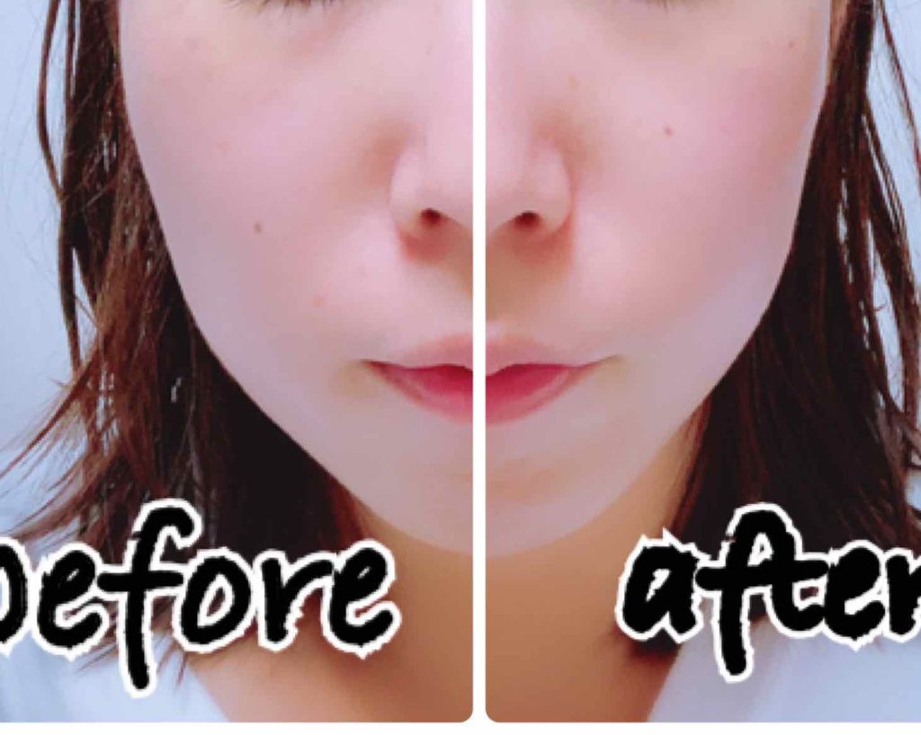 Red BA ギアアップコフレ/Red B.A/スキンケアキットを使ったクチコミ(2枚目)