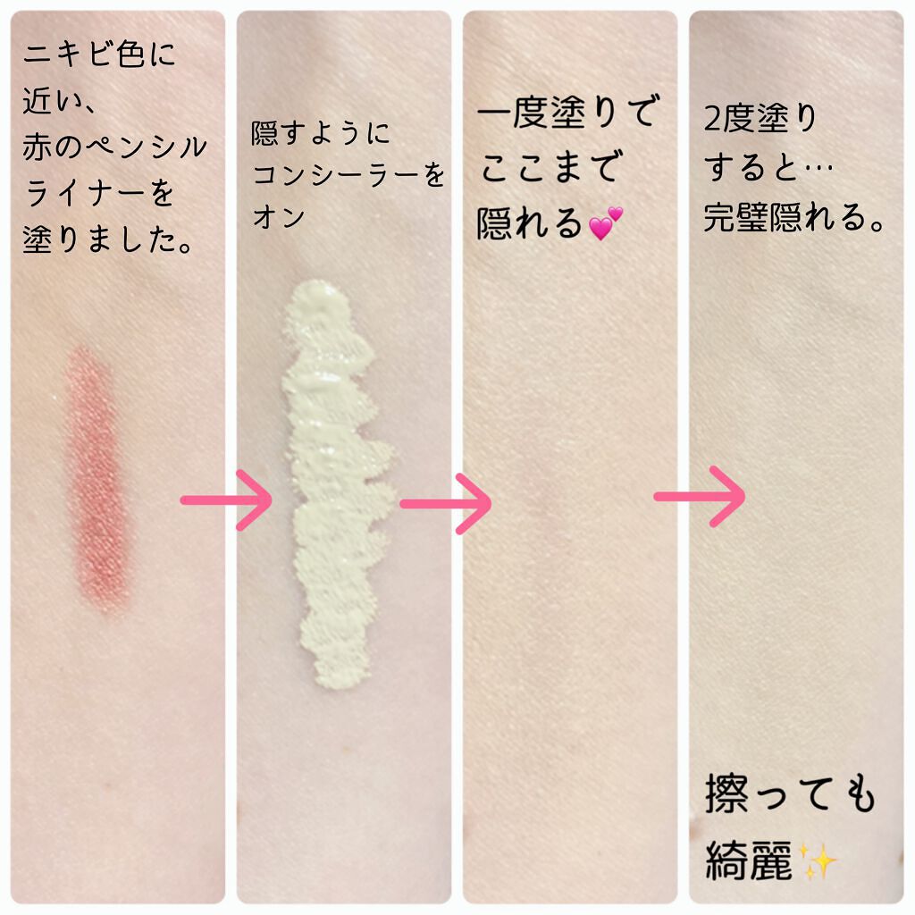 ビッグカバーフィットコンシーラー/ETUDE/リキッドコンシーラーを使ったクチコミ（2枚目）