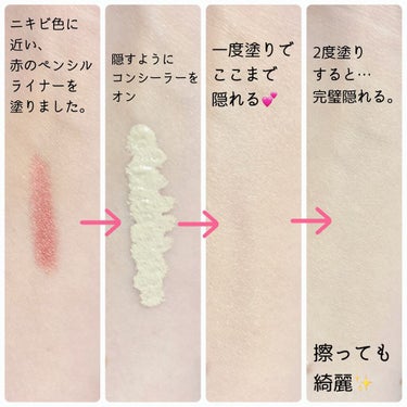 ETUDE ビッグカバーフィットコンシーラーのクチコミ「ニキビやニキビ跡などの赤みをカバーしたい方へ❤️オススメコンシーラー⭐️
✼••┈┈••✼••.....」（2枚目）