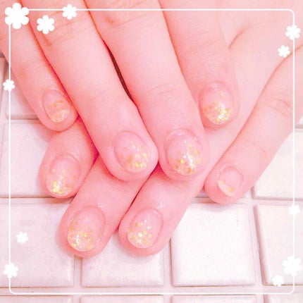 めあり on LIPS 「※深爪矯正のお話の為、深爪だった頃の画像が2.3枚目にございま..」(4枚目)