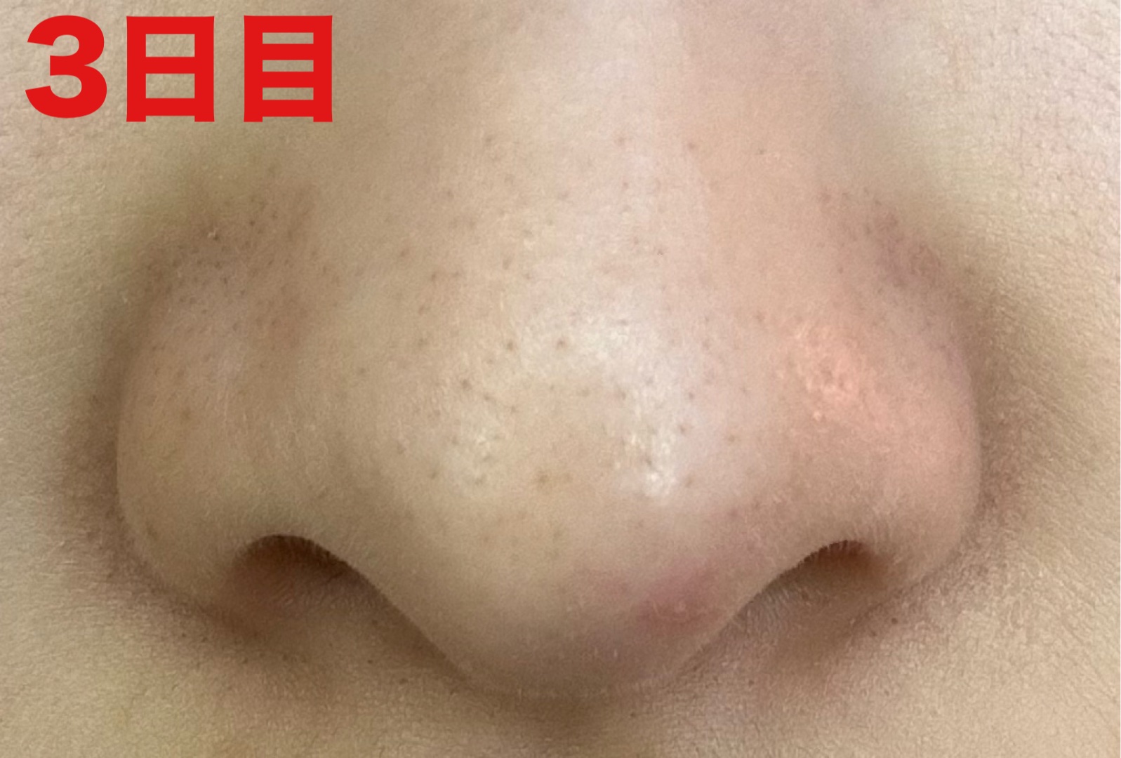 ディープクリア酵素洗顔	/メラノCC/洗顔フォームを使ったクチコミ（2枚目）