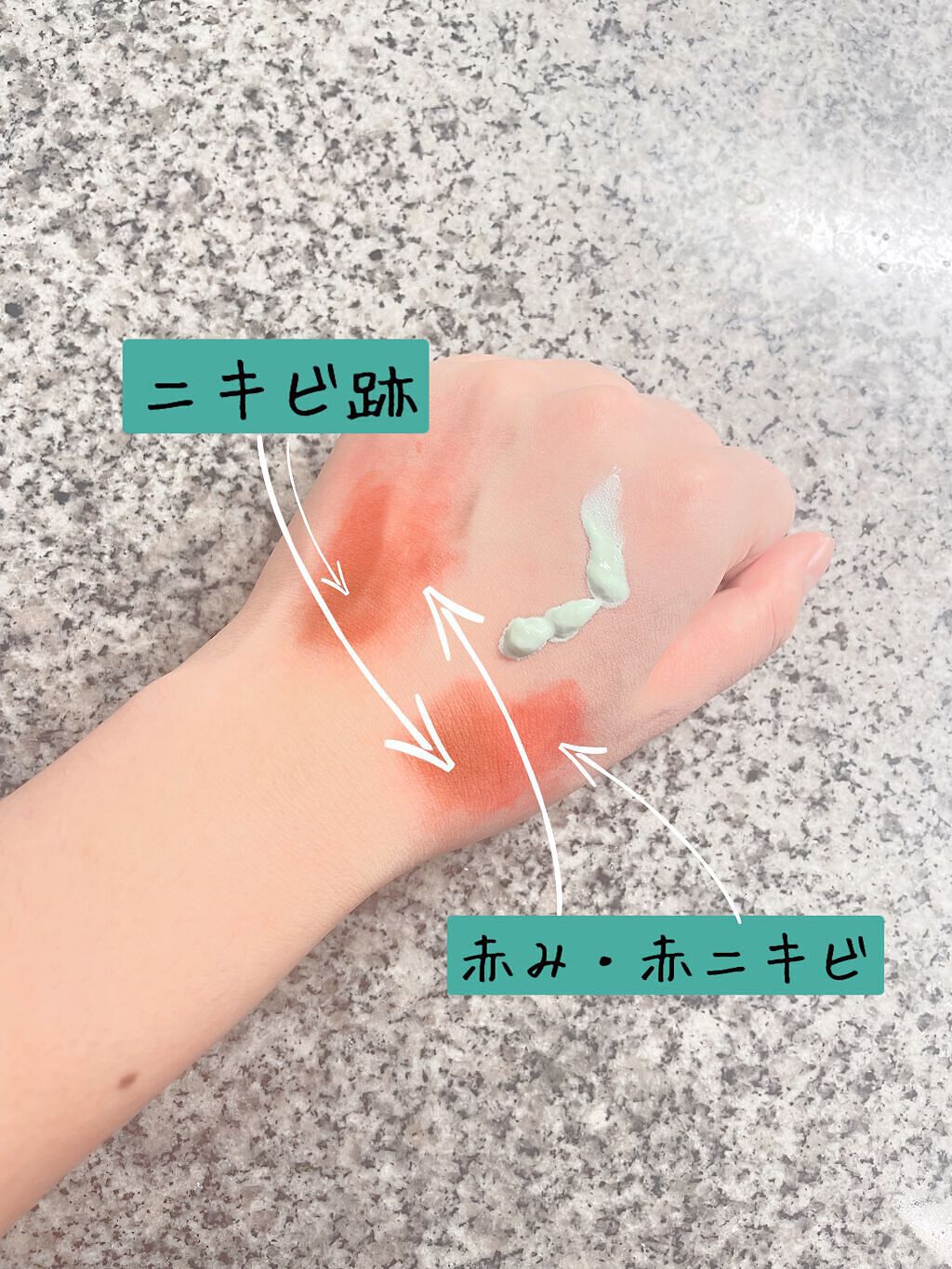 を使ったクチコミ（3枚目）