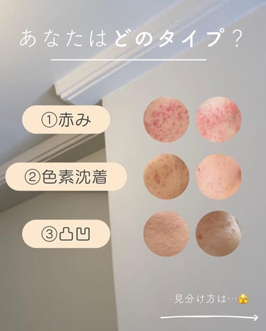 KISO バランシングエッセンス AZのクチコミ「あけましておめでとうございます🎍
今年もみんなよろしくね🫶🏻
⁡
新年一発目の投稿は、フ.....」（3枚目）