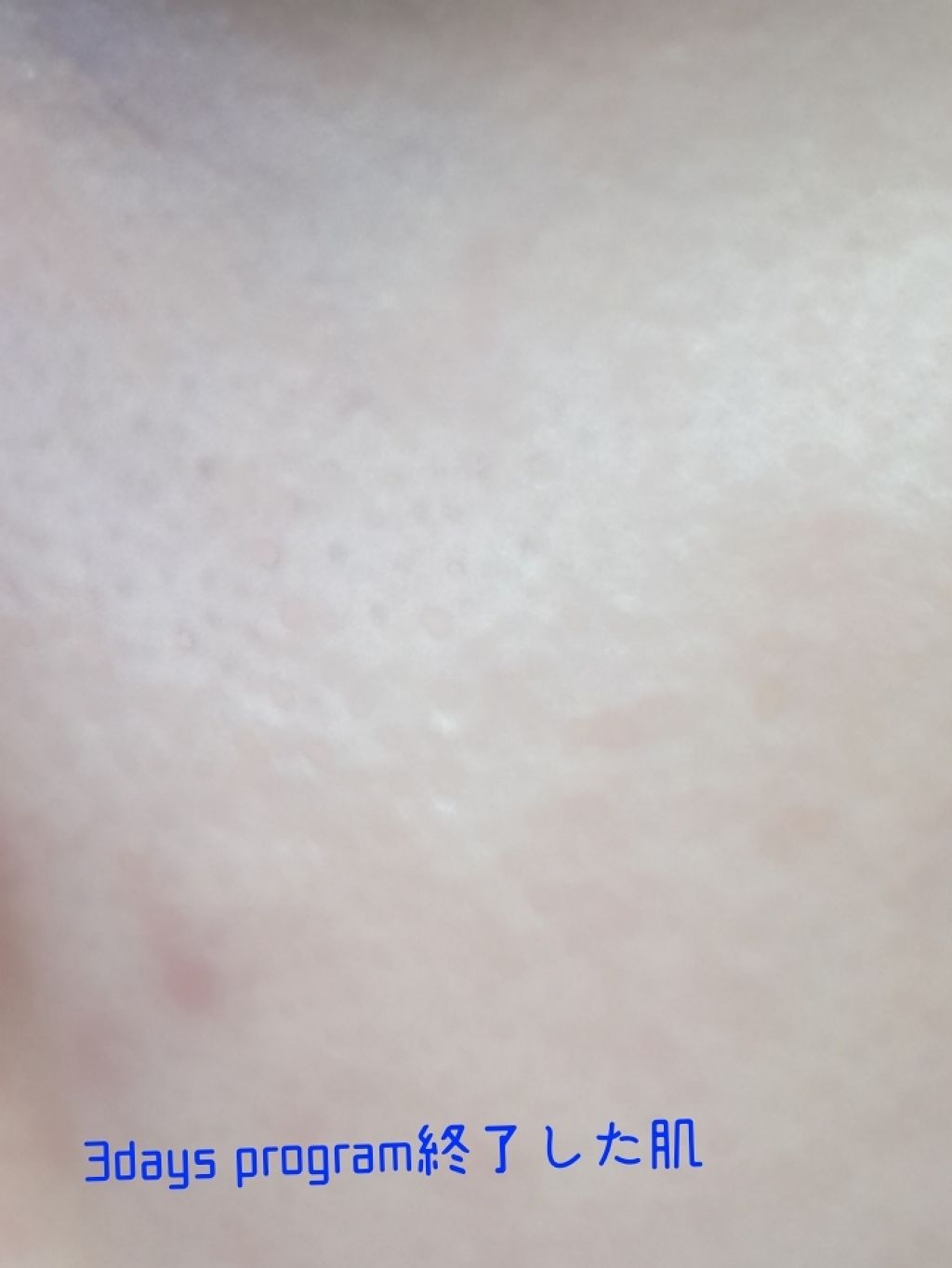 ローション II/BENEFIQUE/化粧水を使ったクチコミ（3枚目）