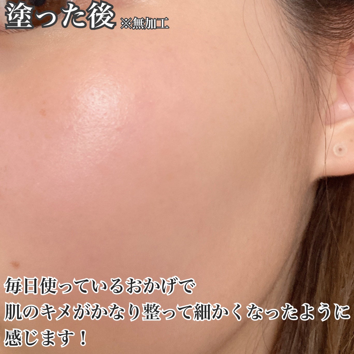 リポソーム アドバンスト リペアセラム/DECORTÉ/美容液を使ったクチコミ(4枚目)