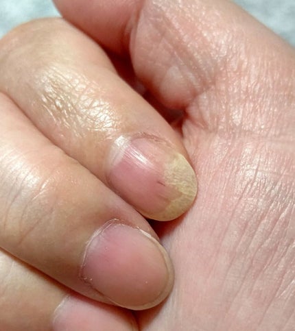 pa ネイルオイル/pa nail collective/ネイルオイル・トリートメントを使ったクチコミ(2枚目)