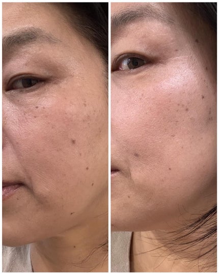 フェイスアップ プレストパウダー SPF23 / PA++/COVERMARK/プレストパウダーを使ったクチコミ(8枚目)